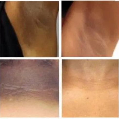 Duo Bundle of Turmeric & 2% Kojic Acid Soap and Scrub